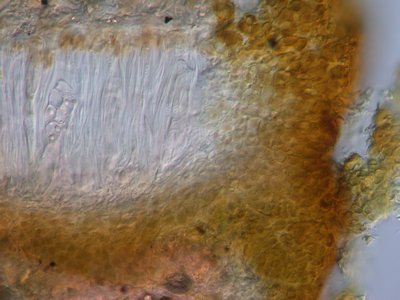 [Psorotichia murorum]